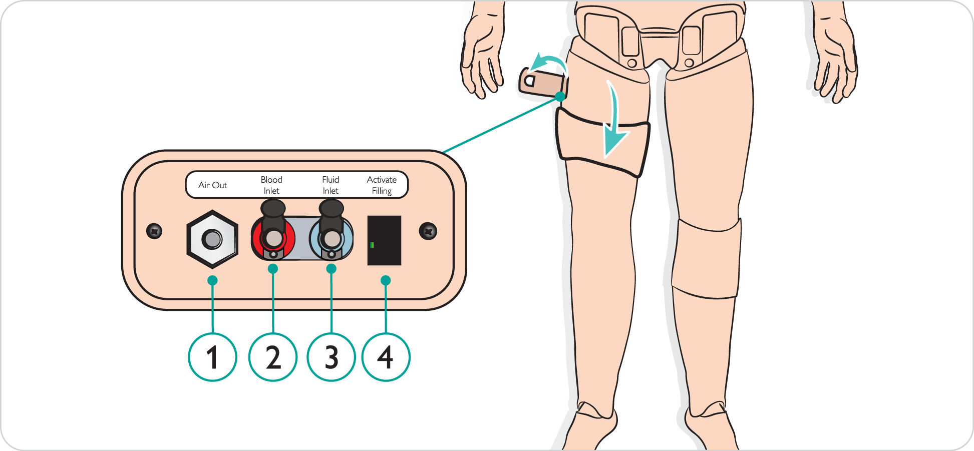 SimManTrauma_DrugArm_Overview_Fluid_Panel.svg