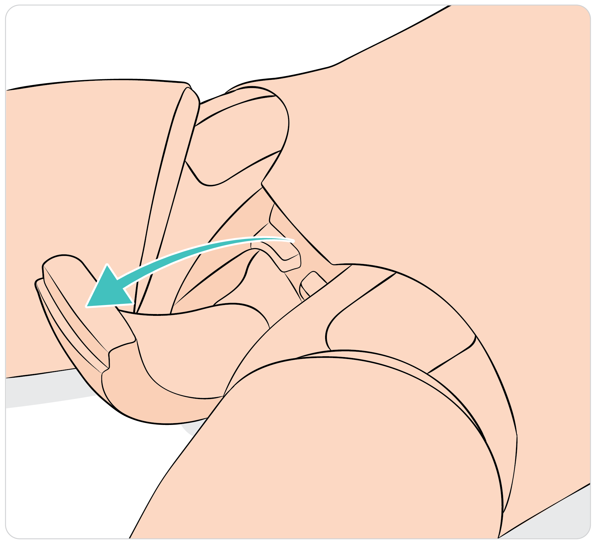 SimManTrauma_DrugArm_Preparing_the_genitalia_and_catheterization_01.png