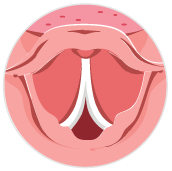 LAAS_laryngospasm_bulb_icon.svg