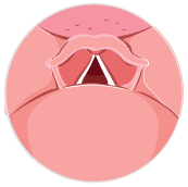 LAAS_pharyngeal_bulb_icon.svg
