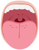 LAAS_tongue_edema_bulb_icon.svg