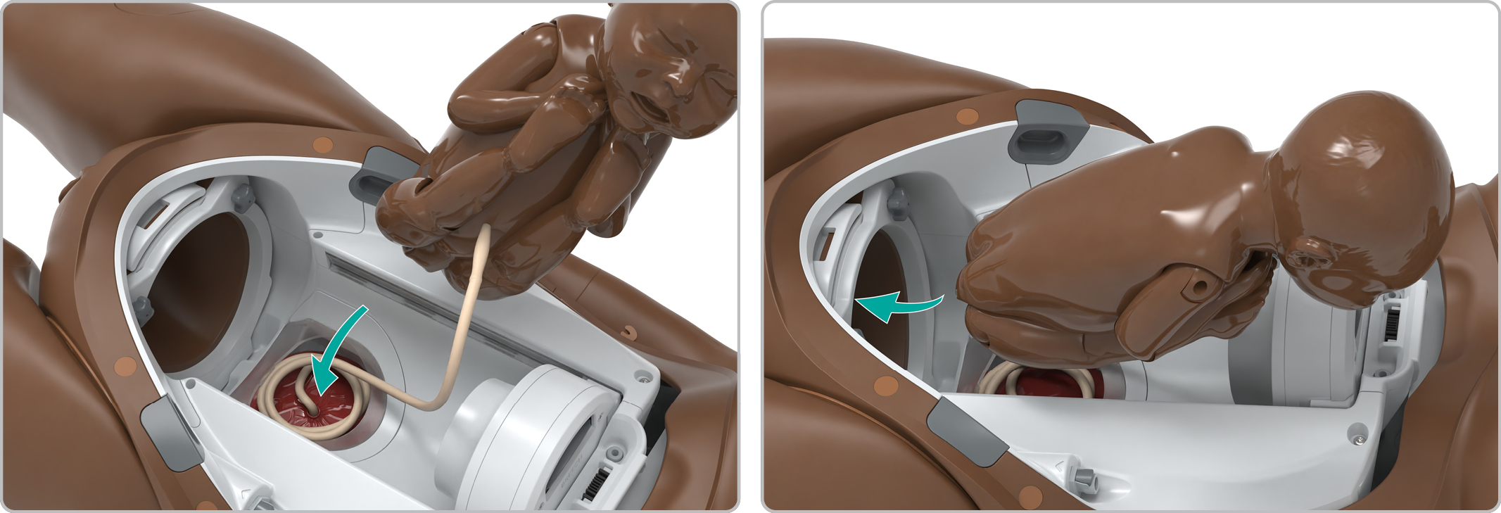 MA_Breech_setup3.jpg