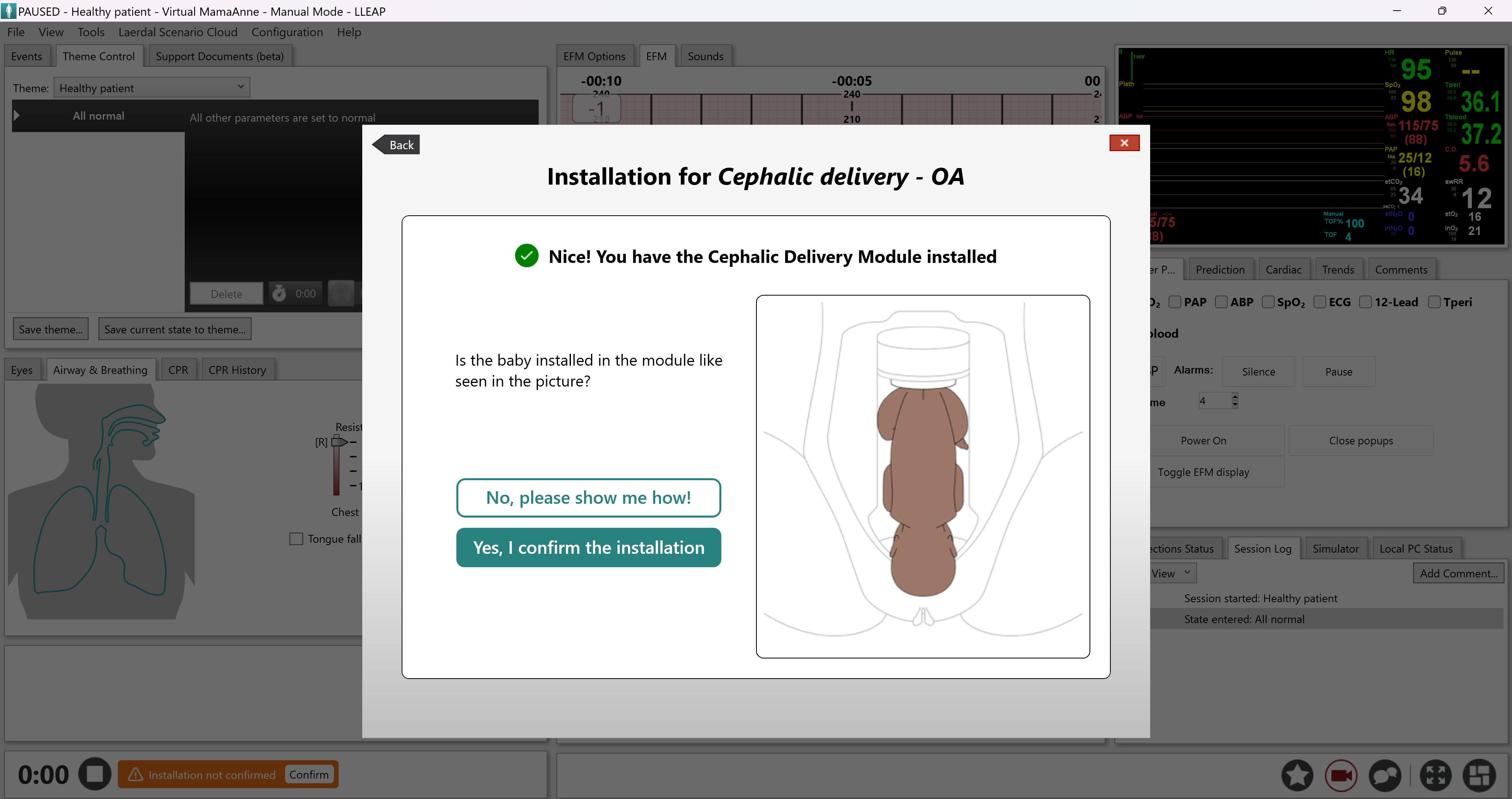 LLEAP_Confirm_Installation_Cephalic_OA.png