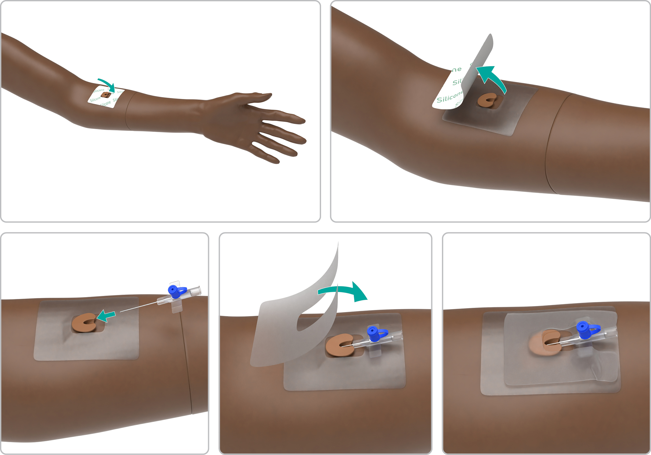 MA_Arm_IV_dressing_base.jpg