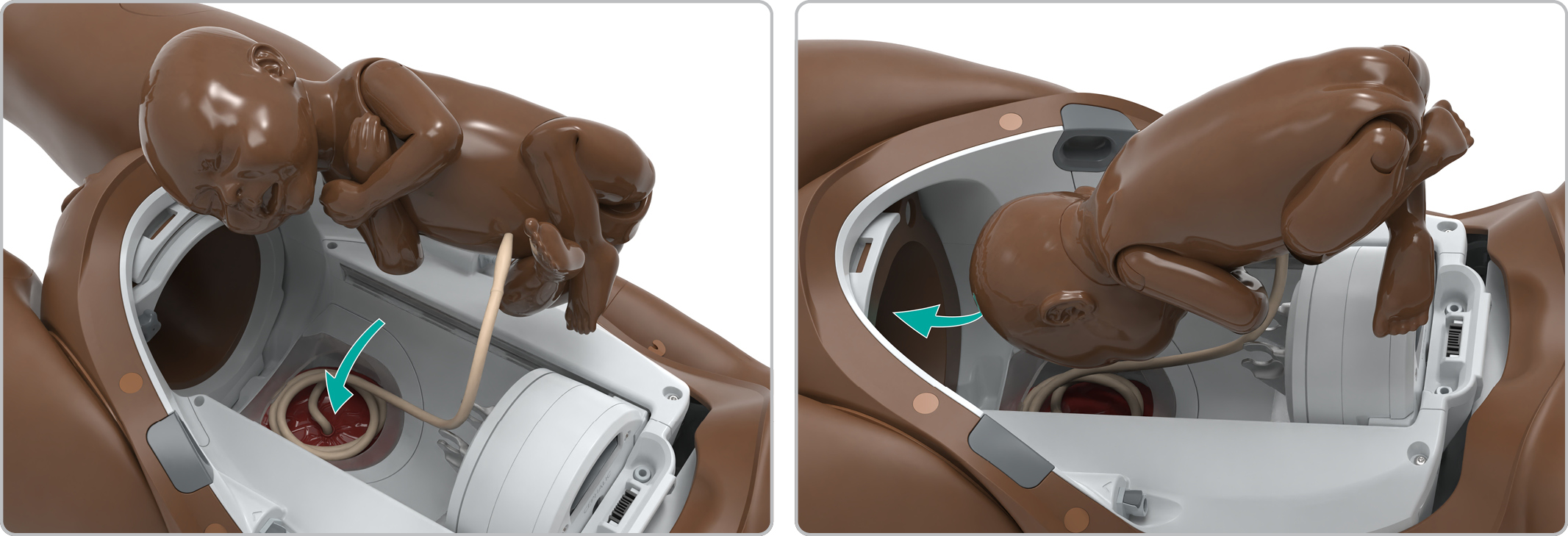 MA_Cephalic_setup3.jpg