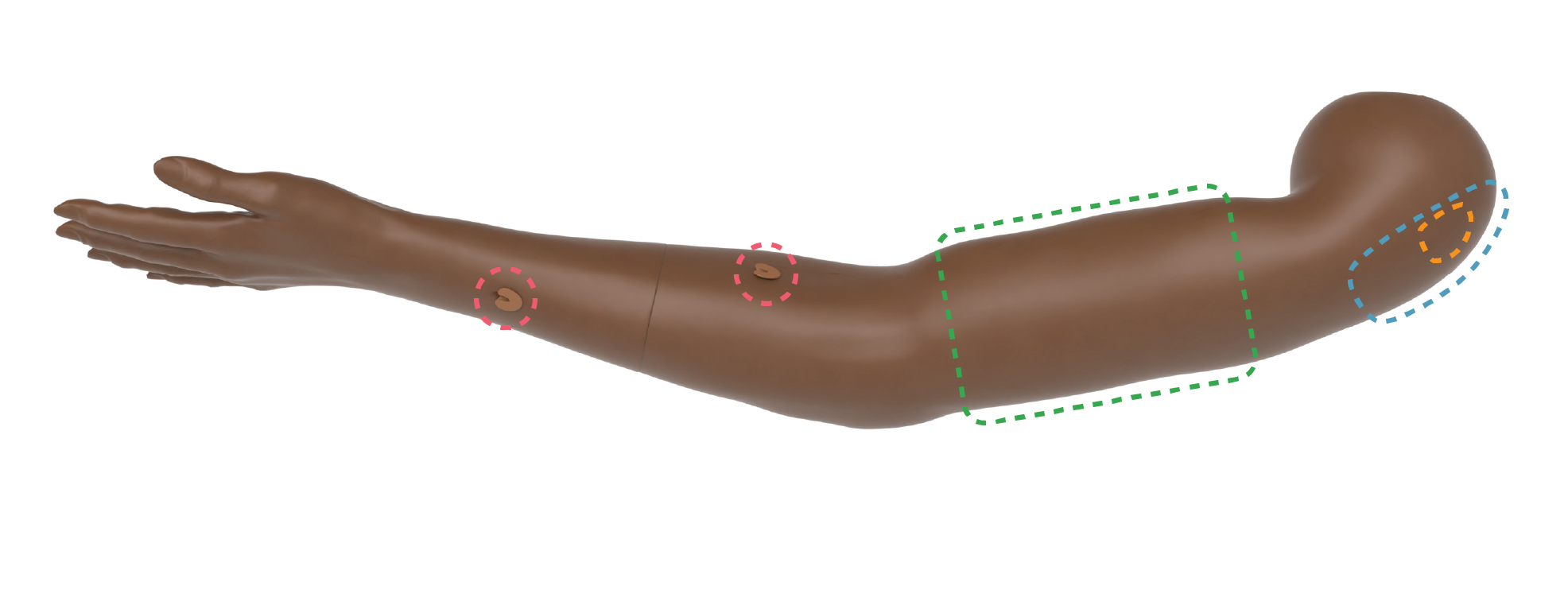 MA_Arm_overview.jpg