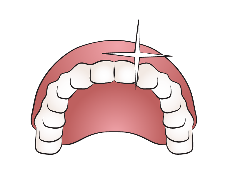 SM_head_teeth_new.png