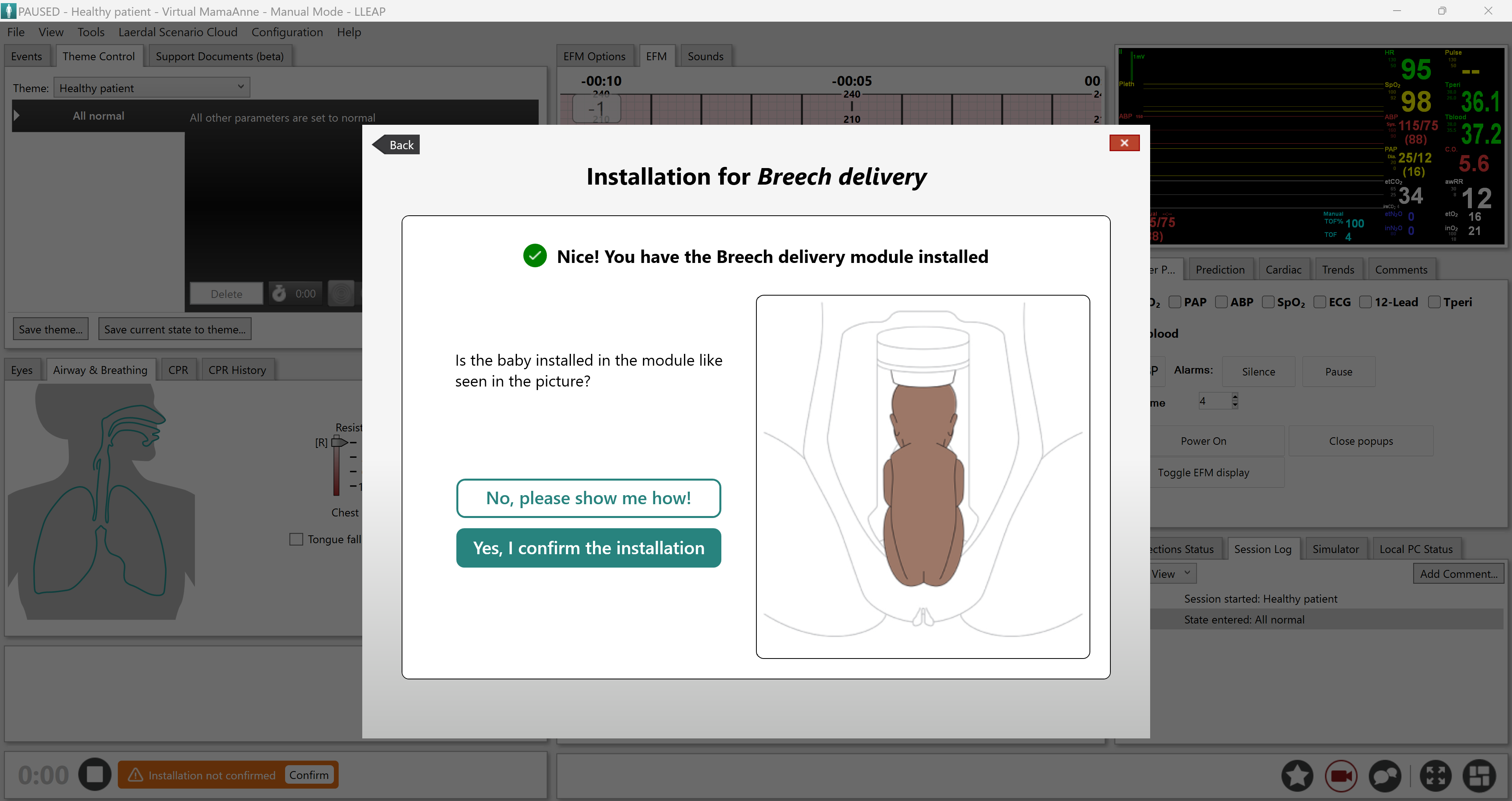 LLEAP_Confirm_Installation_Breech.png