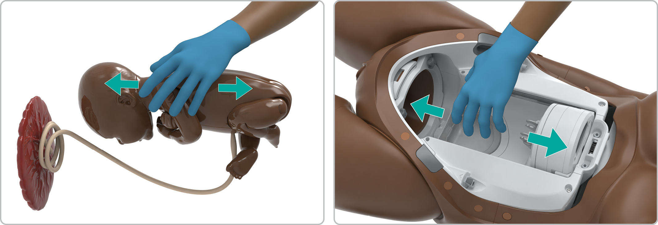 MA_Cephalic_setup2.jpg
