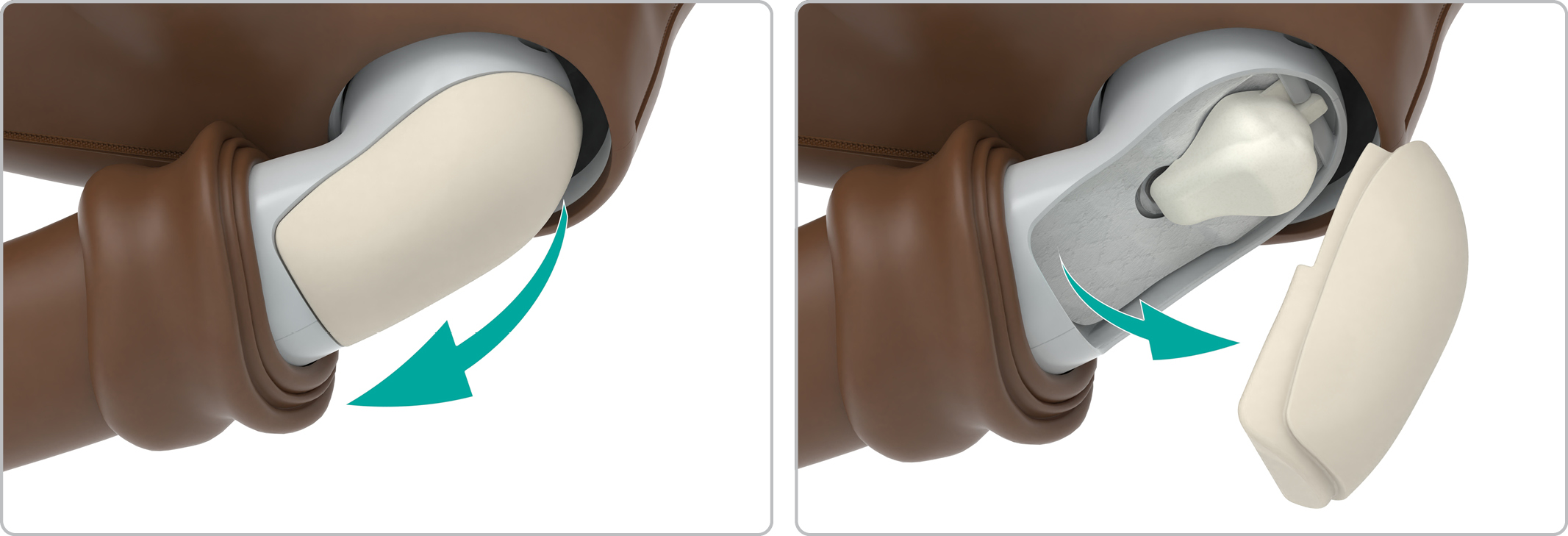 MA_shoulder_skin_down_pad_out.jpg