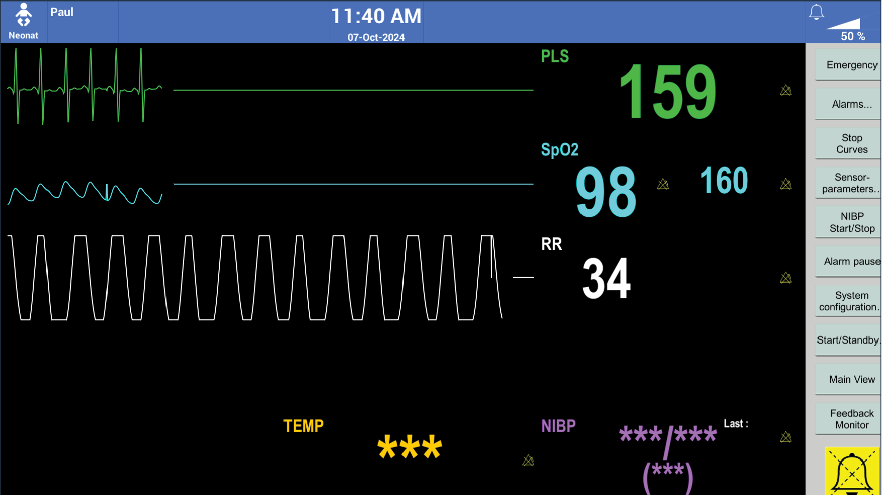 Paul_GUI_patient_monitor_focused_view.png